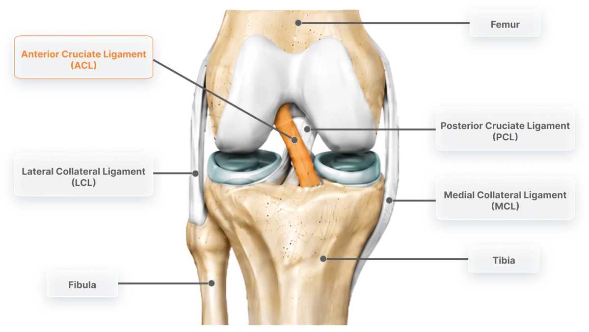 Anatomy of a healthy knee viewed from the front, femur, tibia and fibula with the four main ligaments labelled and the anterior cruciate ligament (ACL) highlighted
