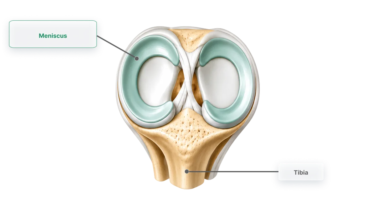 Top-down view of the knee showing the two menisci, the C-shaped cartilage cushions, with the meniscus labelled